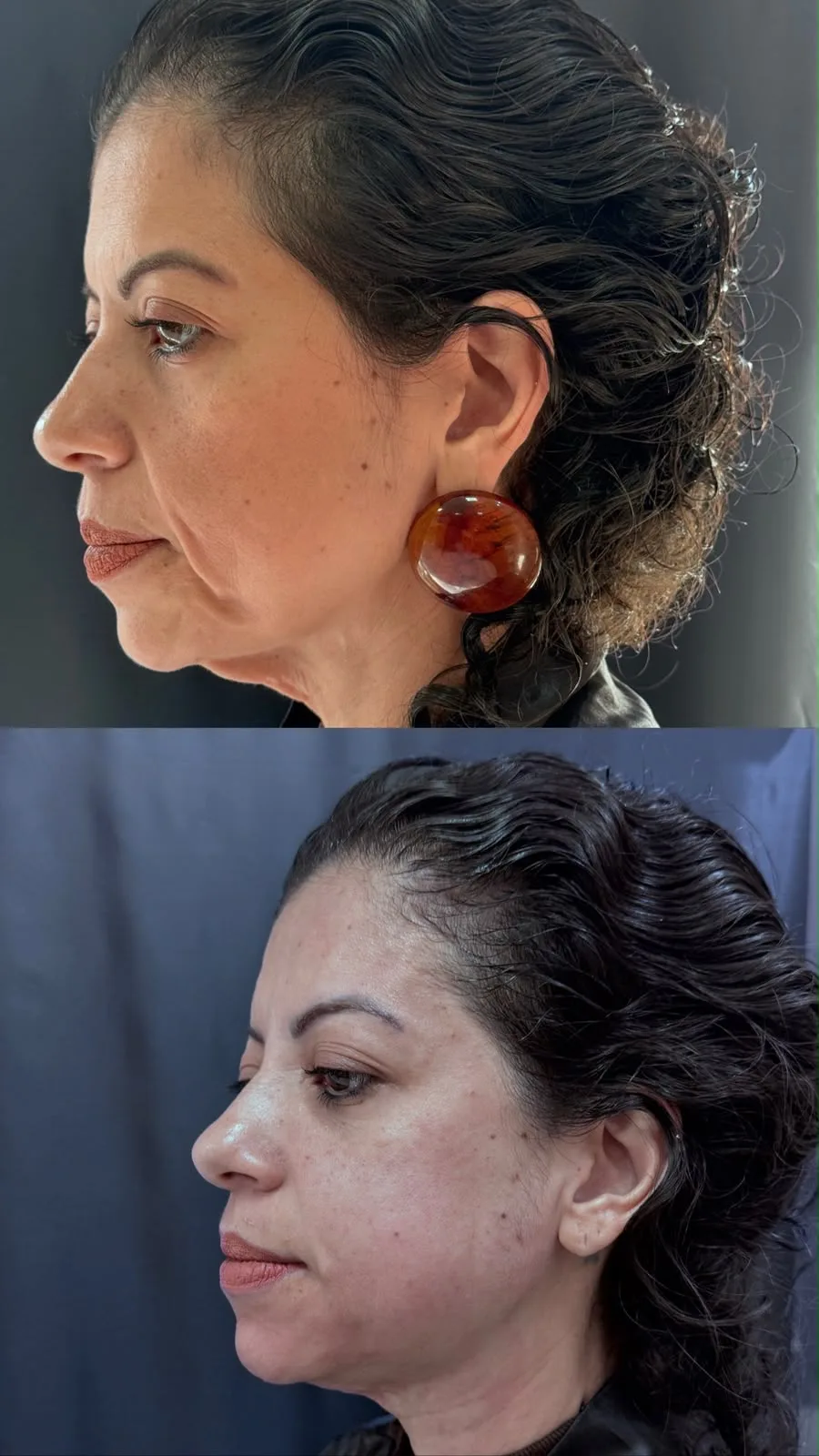 Registro comparativo do perfil de uma paciente acompanhada pela clínica